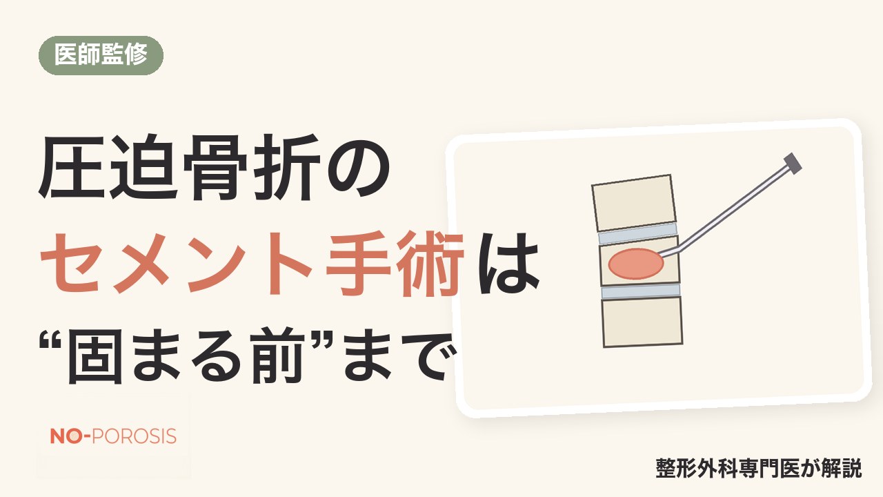 圧迫骨折の「セメント手術」は骨が固まる前まで BKP・VBSをやさしく解説